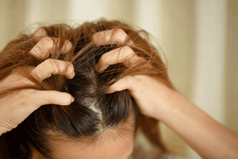 Winter Hair