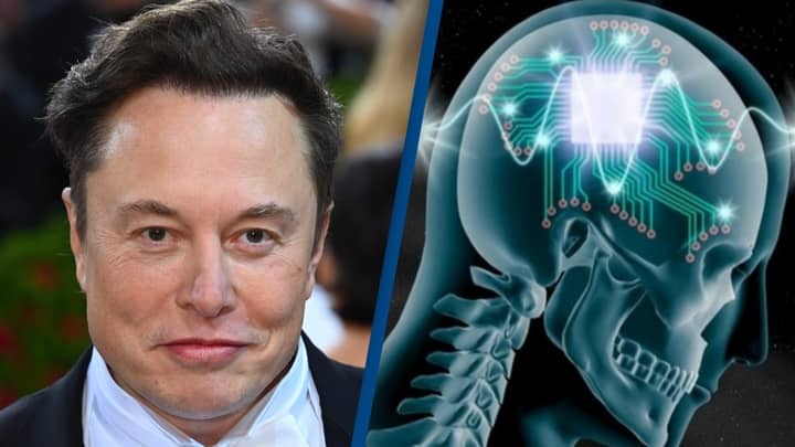 Elon Musk wants to test brain implant in people