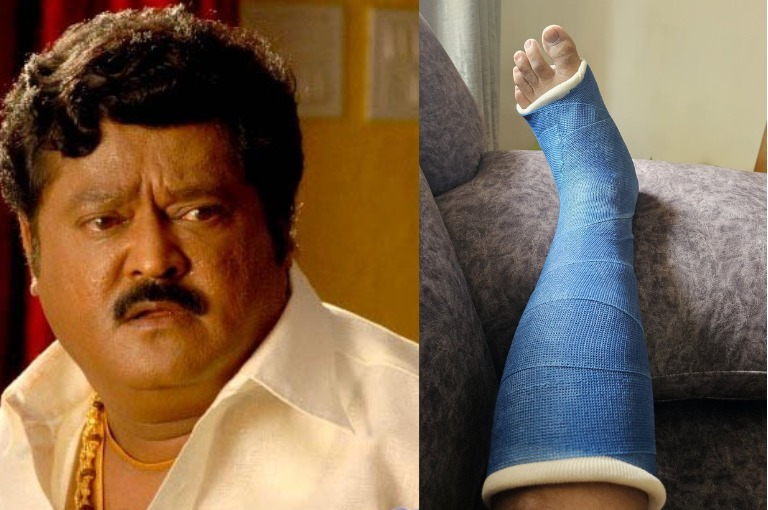 Jaggesh shared a photo of his leg with a bandage here is what happened to him