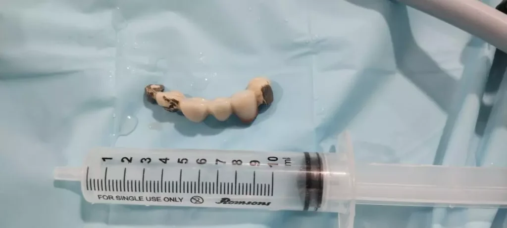 Set Of Teeth